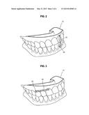 CLEAR ALIGNER AND MANUFACTURING METHOD THEREOF, TRACTION DEVICE FOR CLEAR     ALIGNER, AND AID FOR TRACTION DEVICE FOR CLEAR ALIGNER diagram and image