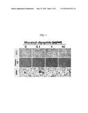 BONE LOSS PREVENTING AND BONE REGENERATION OR BONE FORMATION PROMOTING     PHARMACEUTICAL COMPOSITION COMPRISING MURAMYL DIPEPTIDE diagram and image