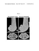 BONE LOSS PREVENTING AND BONE REGENERATION OR BONE FORMATION PROMOTING     PHARMACEUTICAL COMPOSITION COMPRISING MURAMYL DIPEPTIDE diagram and image