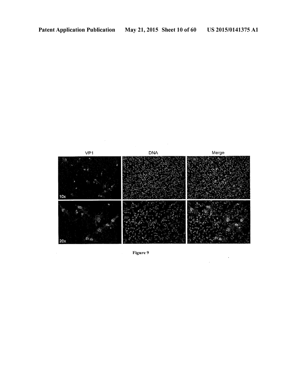 Methods of Treating Viral Associated Diseases - diagram, schematic, and image 11