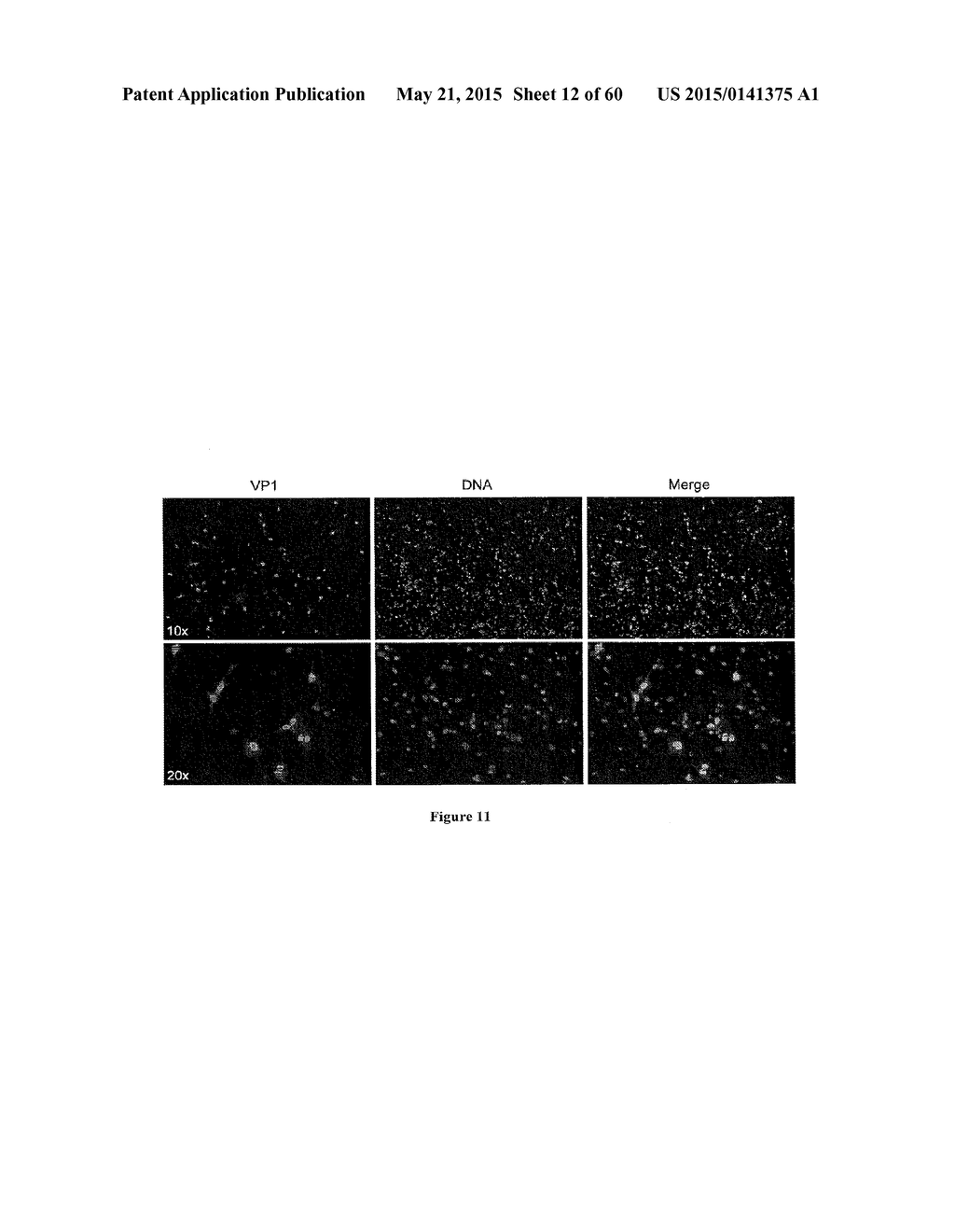 Methods of Treating Viral Associated Diseases - diagram, schematic, and image 13