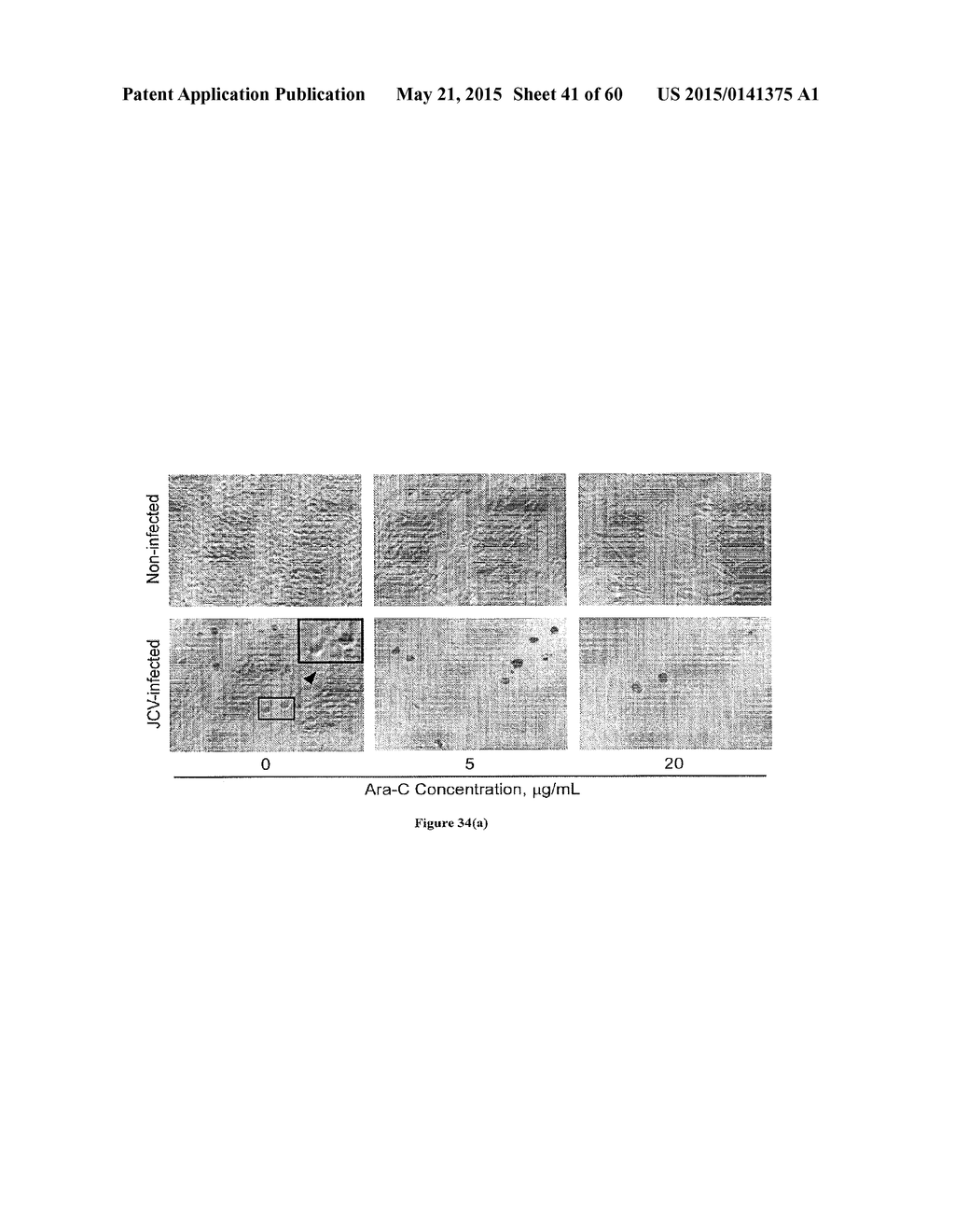 Methods of Treating Viral Associated Diseases - diagram, schematic, and image 42