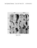 METHOD FOR MODULATING CANONICAL WNT PATHWAY USING FOLATE AND INOSITOL diagram and image