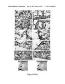 METHOD FOR MODULATING CANONICAL WNT PATHWAY USING FOLATE AND INOSITOL diagram and image