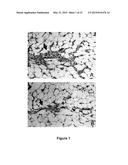 Use Of 2,5-Dihydroxybenzene Compounds And Derivatives For The Treatment Of     Rosacea diagram and image