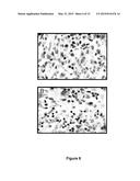 Use Of 2,5-Dihydroxybenzene Compounds And Derivatives For The Treatment Of     Rosacea diagram and image