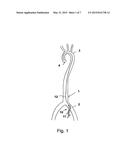 SHEATH DEVICE FOR INSERTING A CATHETER diagram and image