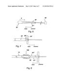 SHEATH DEVICE FOR INSERTING A CATHETER diagram and image