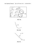 SYSTEMS AND METHODS TO GATHER AND ANALYZE ELECTROENCEPHALOGRAPHIC DATA diagram and image