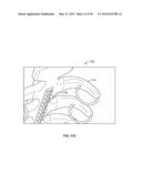 SYSTEMS AND METHODS TO GATHER AND ANALYZE ELECTROENCEPHALOGRAPHIC DATA diagram and image