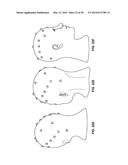 SYSTEMS AND METHODS TO GATHER AND ANALYZE ELECTROENCEPHALOGRAPHIC DATA diagram and image