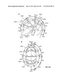 SYSTEMS AND METHODS TO GATHER AND ANALYZE ELECTROENCEPHALOGRAPHIC DATA diagram and image