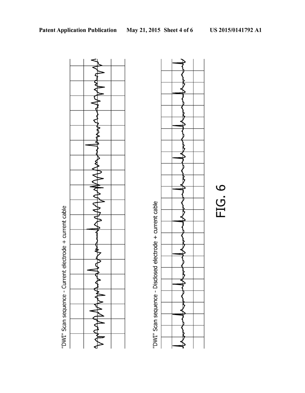 MAGNETIC RESONANCE SAFE CABLE FOR BIOPOTENTIAL MEASUREMENTS - diagram, schematic, and image 05