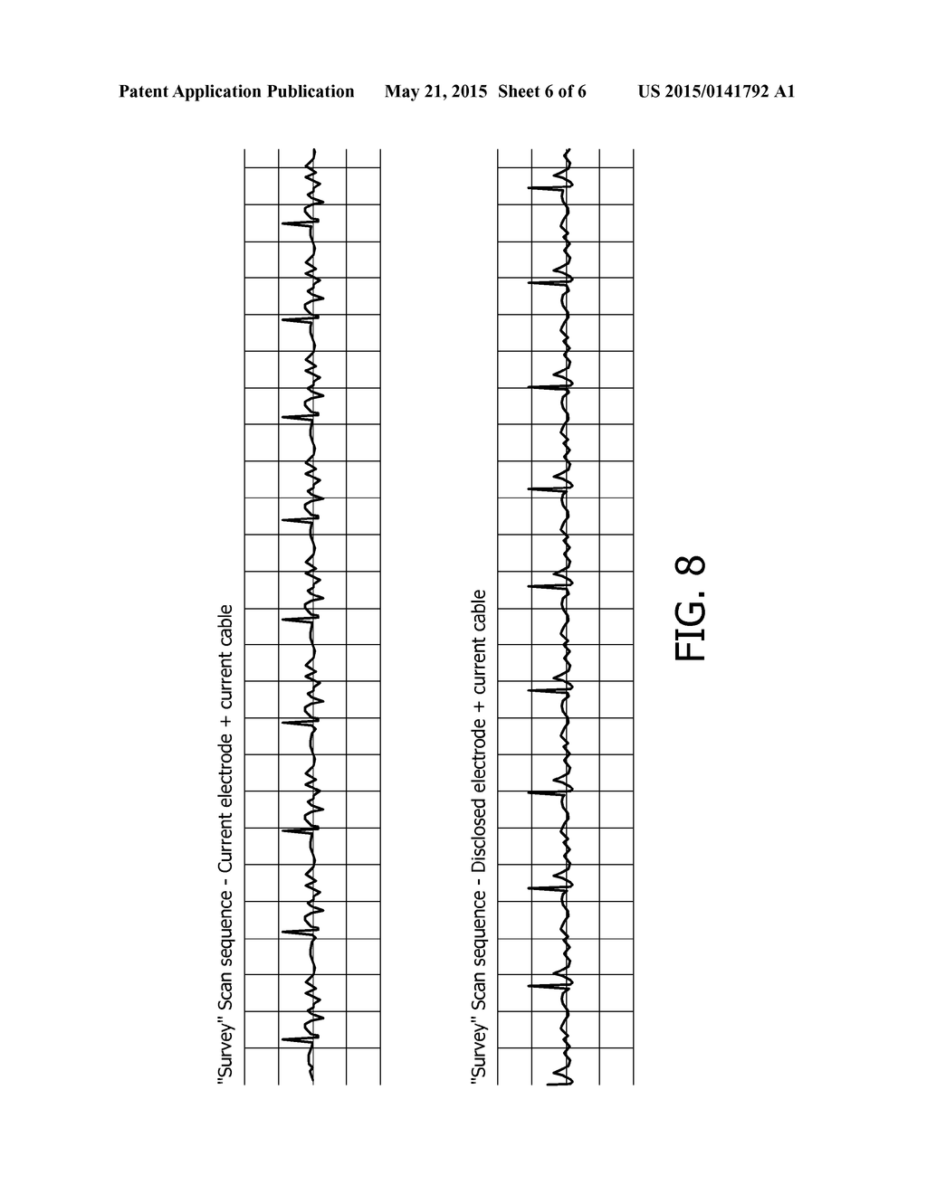 MAGNETIC RESONANCE SAFE CABLE FOR BIOPOTENTIAL MEASUREMENTS - diagram, schematic, and image 07