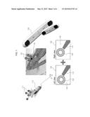 METHOD OF TRACKING AN AFFECTED AREA AND A SURGICAL EQUIPMENT diagram and image