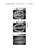 HIGH-RESOLUTION METABOLIC NEUROIMAGING diagram and image