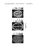 HIGH-RESOLUTION METABOLIC NEUROIMAGING diagram and image