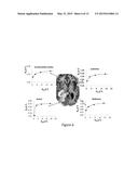 HIGH-RESOLUTION METABOLIC NEUROIMAGING diagram and image