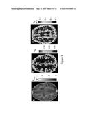 HIGH-RESOLUTION METABOLIC NEUROIMAGING diagram and image