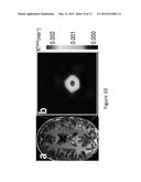 HIGH-RESOLUTION METABOLIC NEUROIMAGING diagram and image