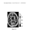 HIGH-RESOLUTION METABOLIC NEUROIMAGING diagram and image