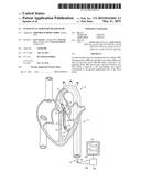 INTRAVASCULAR ROTARY BLOOD PUMP diagram and image