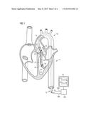 INTRAVASCULAR ROTARY BLOOD PUMP diagram and image