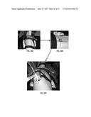 SYSTEM AND METHOD USEFUL FOR SARCOMERE IMAGING VIA OBJECTIVE-BASED     MICROSCOPY diagram and image