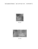 SYSTEMS AND METHODS FOR HYPERSPECTRAL ANALYSIS OF CARDIAC TISSUE diagram and image