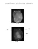 SYSTEMS AND METHODS FOR HYPERSPECTRAL ANALYSIS OF CARDIAC TISSUE diagram and image