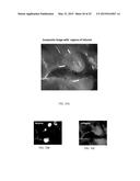 SYSTEMS AND METHODS FOR HYPERSPECTRAL ANALYSIS OF CARDIAC TISSUE diagram and image