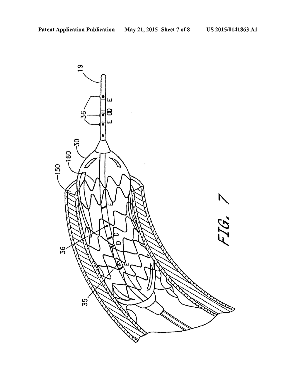 DEVICES AND SYSTEMS FOR OBTAINING IMPEDANCE DATA - diagram, schematic, and image 08