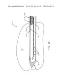 BIOPSY DEVICE WITH TRANSLATING VALVE MEMBER diagram and image