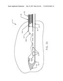 BIOPSY DEVICE WITH TRANSLATING VALVE MEMBER diagram and image