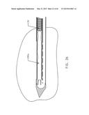 BIOPSY DEVICE WITH TRANSLATING VALVE MEMBER diagram and image