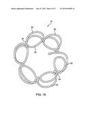 DEVICE AND METHOD FOR ESTABLISHING AN ARTIFICIAL ARTERIO-VENOUS FISTULA diagram and image