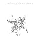 DEVICE AND METHOD FOR ESTABLISHING AN ARTIFICIAL ARTERIO-VENOUS FISTULA diagram and image