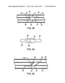 DEVICE AND METHOD FOR ESTABLISHING AN ARTIFICIAL ARTERIO-VENOUS FISTULA diagram and image