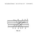 DEVICE AND METHOD FOR ESTABLISHING AN ARTIFICIAL ARTERIO-VENOUS FISTULA diagram and image