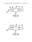 DEVICE AND METHOD FOR ESTABLISHING AN ARTIFICIAL ARTERIO-VENOUS FISTULA diagram and image