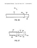 DEVICE AND METHOD FOR ESTABLISHING AN ARTIFICIAL ARTERIO-VENOUS FISTULA diagram and image