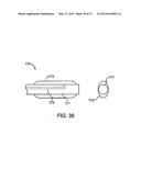 DEVICE AND METHOD FOR ESTABLISHING AN ARTIFICIAL ARTERIO-VENOUS FISTULA diagram and image