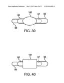 DEVICE AND METHOD FOR ESTABLISHING AN ARTIFICIAL ARTERIO-VENOUS FISTULA diagram and image