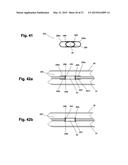 DEVICE AND METHOD FOR ESTABLISHING AN ARTIFICIAL ARTERIO-VENOUS FISTULA diagram and image