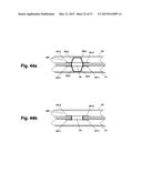 DEVICE AND METHOD FOR ESTABLISHING AN ARTIFICIAL ARTERIO-VENOUS FISTULA diagram and image