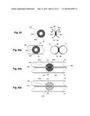 DEVICE AND METHOD FOR ESTABLISHING AN ARTIFICIAL ARTERIO-VENOUS FISTULA diagram and image