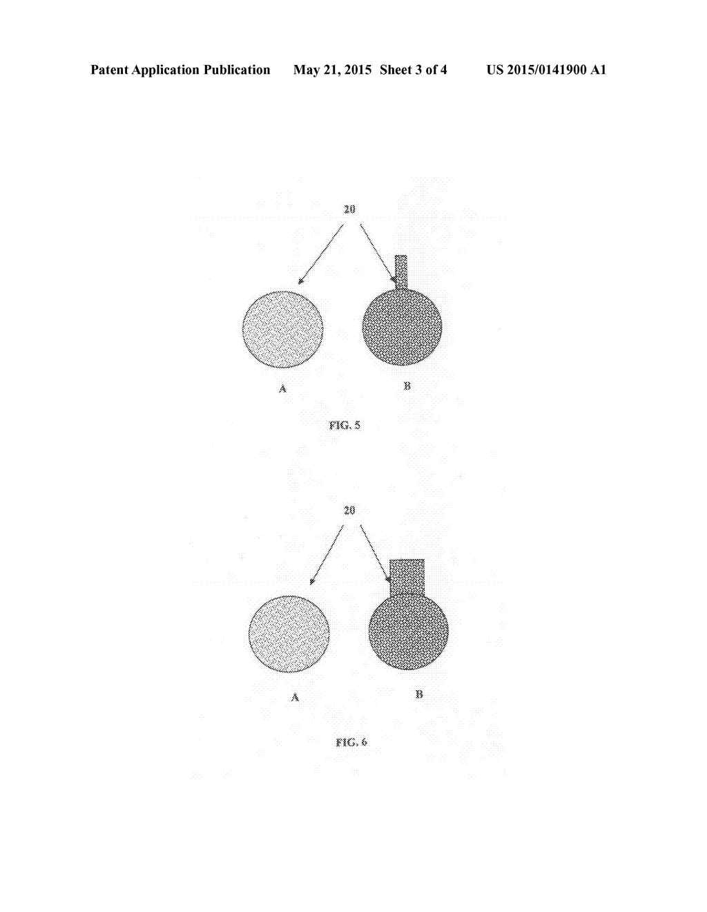 Method and Device for Targeted Delivery of Fluid Therapeutics - diagram, schematic, and image 04