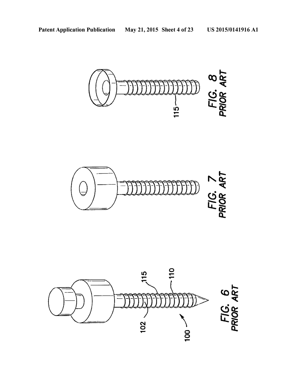 BALLOON TROCAR - diagram, schematic, and image 05