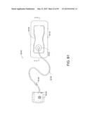 APPARATUSES AND METHODS FOR NEGATIVE PRESSURE WOUND THERAPY diagram and image