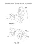 APPARATUSES AND METHODS FOR NEGATIVE PRESSURE WOUND THERAPY diagram and image